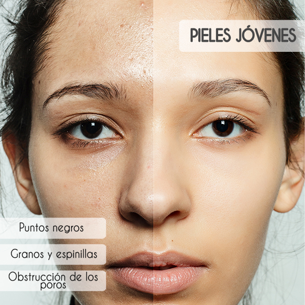 pieles jovenes pieles jovenes